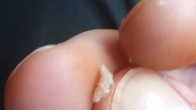 Its lump