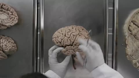 Neuroanatomy S1 E1_ Intro to the Central Nervous System #neuroanatomy #science #medicine #brain