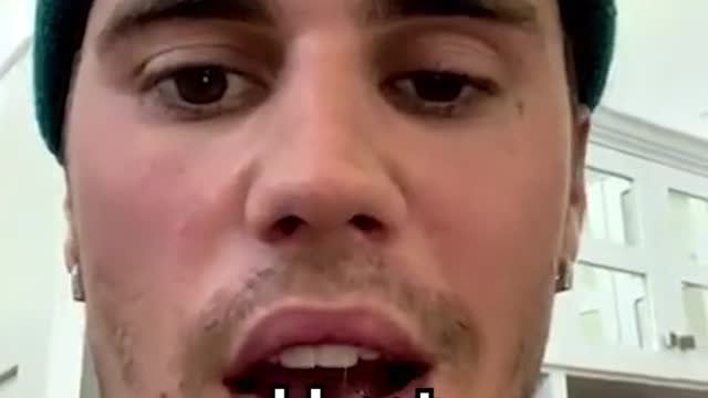 #JustinBieber revealed he's been diagnosed with Ramsay Hunt synd...