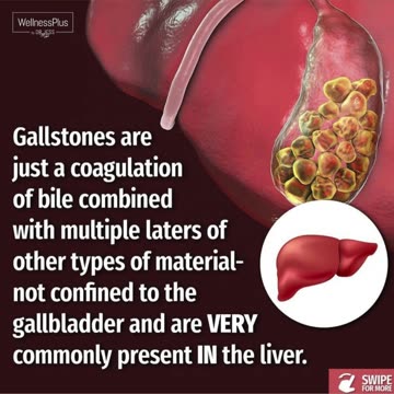 Liver & Gallbladder Health