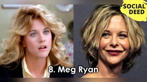 Top 10 Celebrity Plastic Surgery Fails