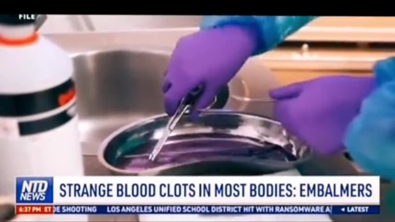 Vaccine Side effects