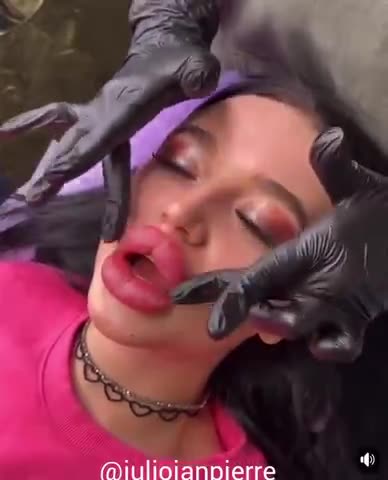 People actually pay to have this done to their LIPS👄. Wait till the end.