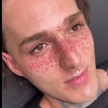 Gen Z Is Now Tattooing Freckles Onto Their Faces