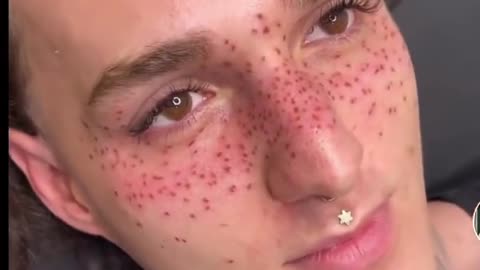 Gen Z Is Now Tattooing Freckles Onto Their Faces