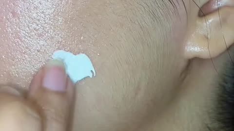 To achieve your ideal skin