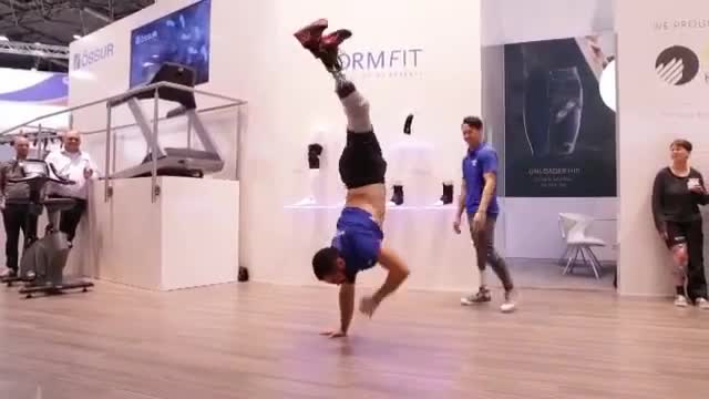 Hiphop dance with prosthetic leg.