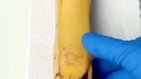 banana gives birth _asmr doctors treatment shorts animation video #asmr #shorts #youtubeshorts