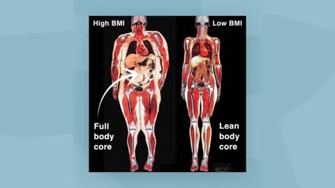 Understanding Internal vs External Fat and Liposuction