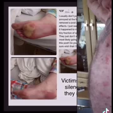 Vaccine Damage 101 Educational Info