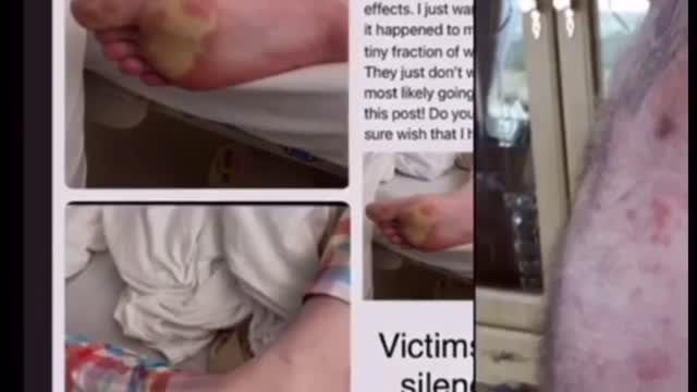 Vaccine Damage 101 Educational Info