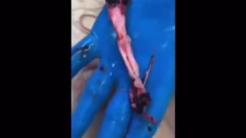 Τρόμαξαν με αυτά που βρήκαν στο σώμα νεκρού άνδρα!