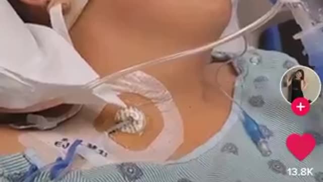Žena iz videa koja snima pojašnjava od čega je nastradala osoba koju snima.
