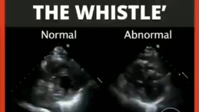 E.R. DOCTOR BLOWS WHISTLE ON VAXXINE DAMAGE IN CHILDREN