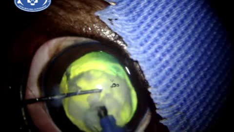 Cataract and Retinal Surgery in Dogs
