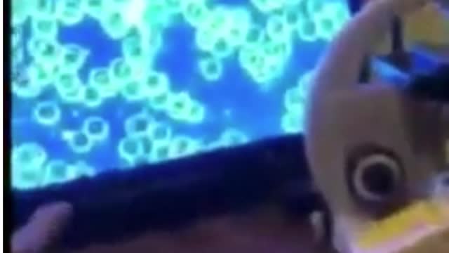 Doctor Looks At Vaccinated and Unvaccinated Blood - coin stacking