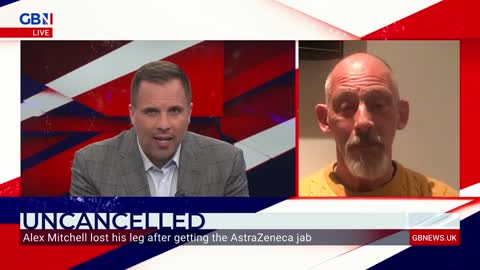 Uncancelled: Alex Mitchell lost his leg after getting the AstrZeneca Jab