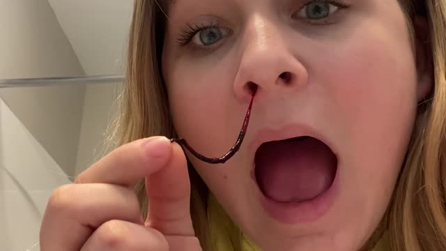 Parasite out of nose.