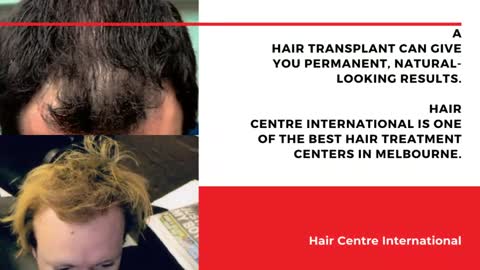 Hair Growth Treatment in Melbourne- HC International