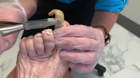SHOCKINGLY LONG LONG Toenails