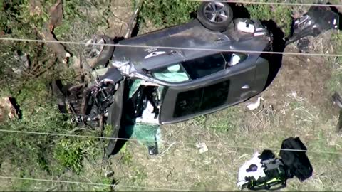 Tiger Woods hospitalized after car accident