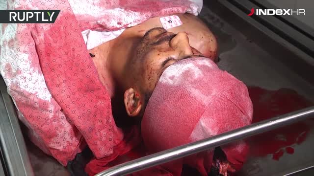 Žrtve krvavih napada u Gazi