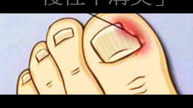 防疫勤洗手 「慢性甲溝炎」