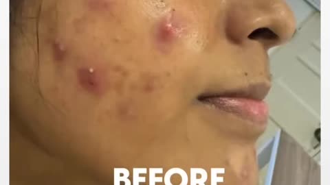 To achieve your ideal skin