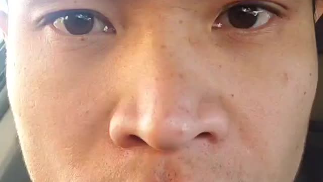 My face