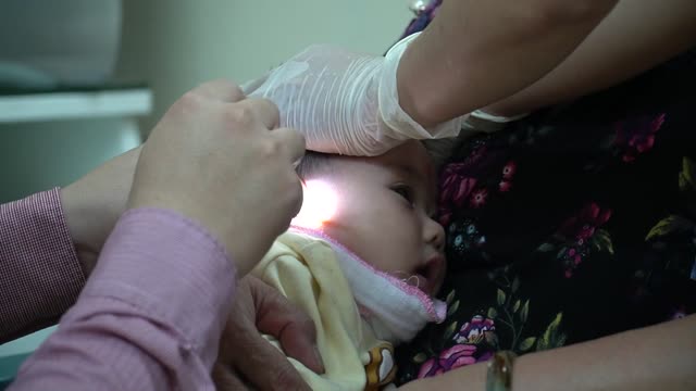 Doctor check up baby very cute expression