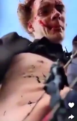 Idiot Man Climbs High Voltage Line And Somehow Lives