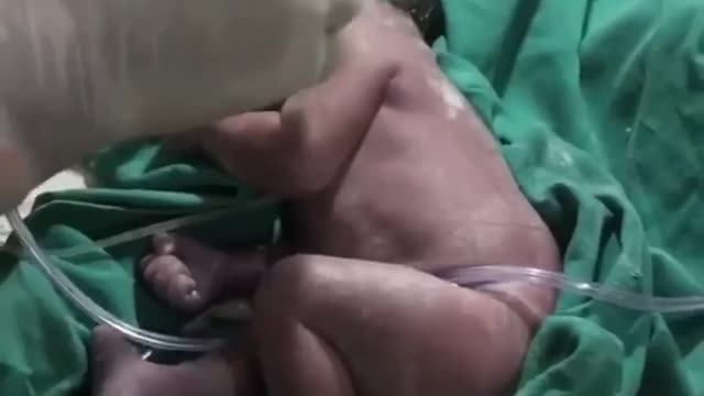 Please donate share video 😰😭😭🙏🙏