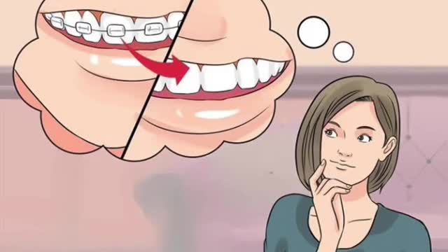 D #braces