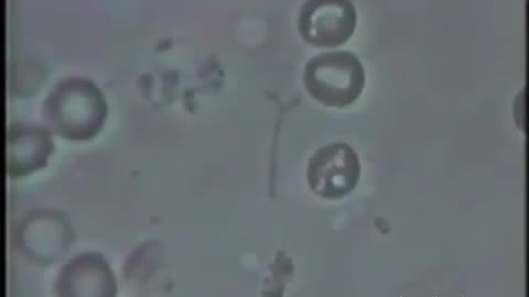 Transformation of anthrax bacteria into a blood cell, after blood alkalization