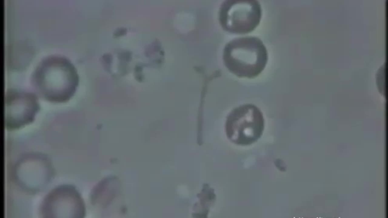 Transformation of anthrax bacteria into a blood cell, after blood alkalization