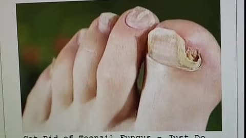 Disgusting toes