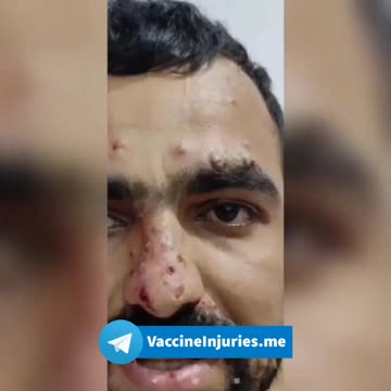 Sinopharm 💉 26-Year-Old