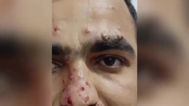 Sinopharm 💉 26-Year-Old