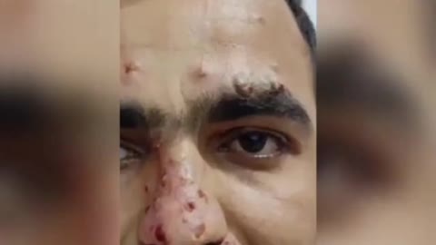 Sinopharm 💉 26-Year-Old