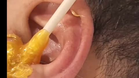 Ear Waxing with Sexy Smooth Golden Allure Hard Wax by @z_luxehouseofbeauty