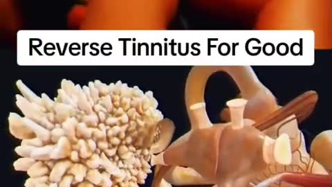 FACT: Tinnitus is KILLING your brain🧠