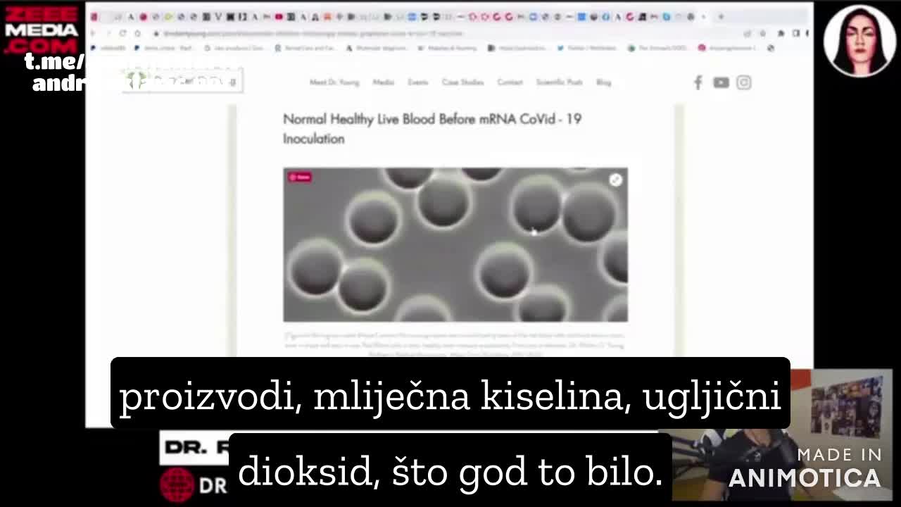 Ne postoji gripa samo prirodni odgovor tijela da očisti toksine, od kojih neki dolaze iz 5G