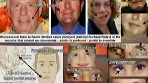 Vaccine injuries, Dr. Andrew Moulden, Conférence Liberté de Choix en Santé, Mont