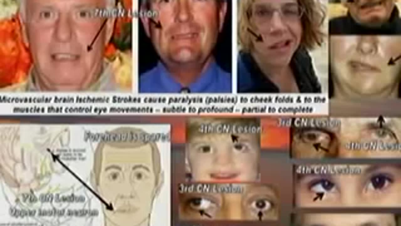 Vaccine injuries, Dr. Andrew Moulden, Conférence Liberté de Choix en Santé, Mont