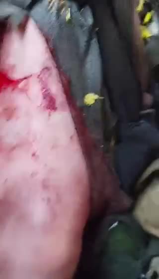 Ukraine: Mercenaries leaving a battle of Severodonetsk in different condition then how they arrived