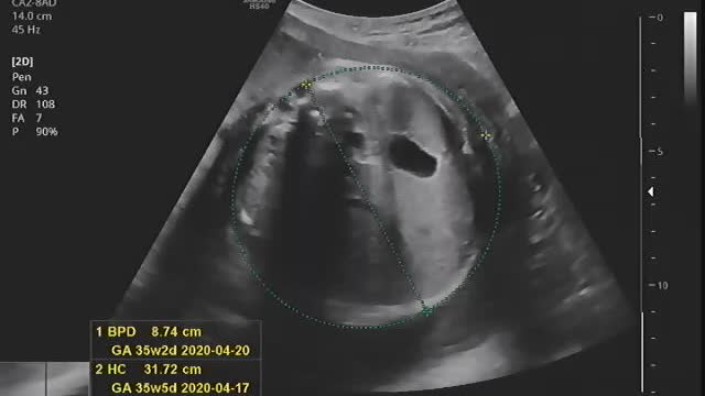 Baby ultrasound image and sound (7)