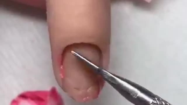 My client got something stuck in her finger ?