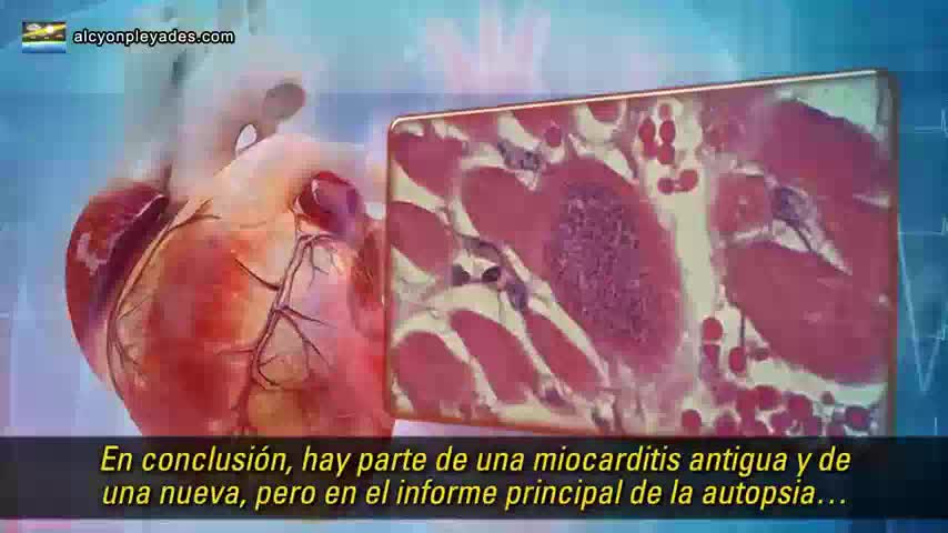 Cáncer y otras enfermedades son solo una fracción de lo que está ocurriendo tras la vacuna covid