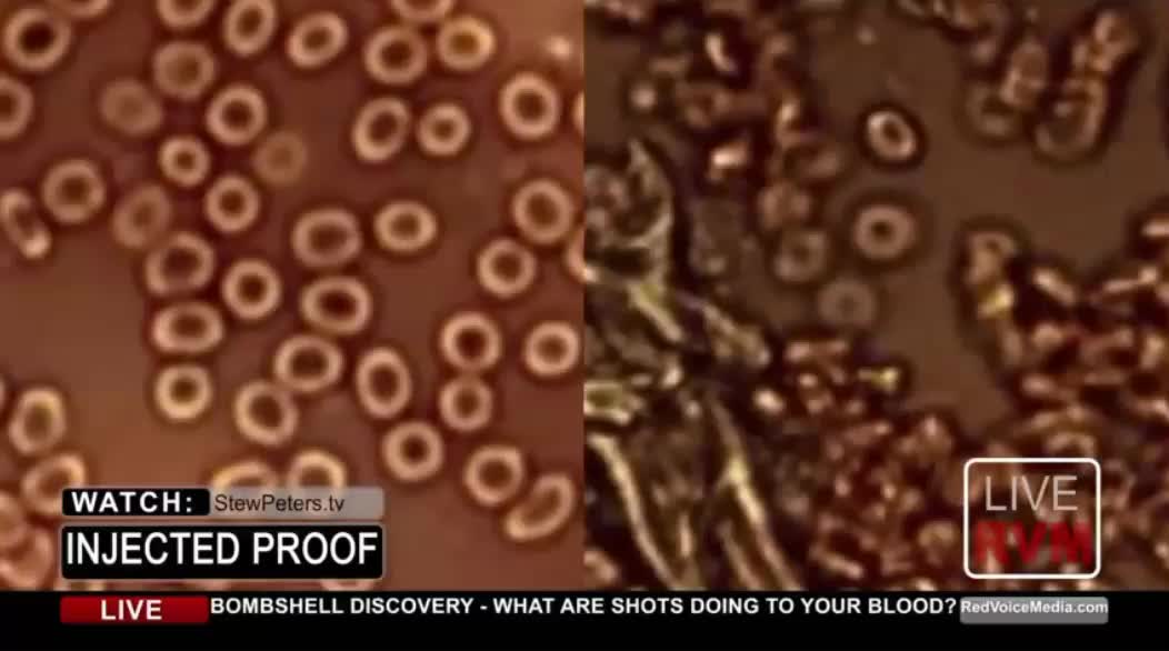 DR.JANE RUBY: PROOF !!! WHAT ARE SHOTS DOING TO YOUR BLOOD??? BOMBSHELL !!!