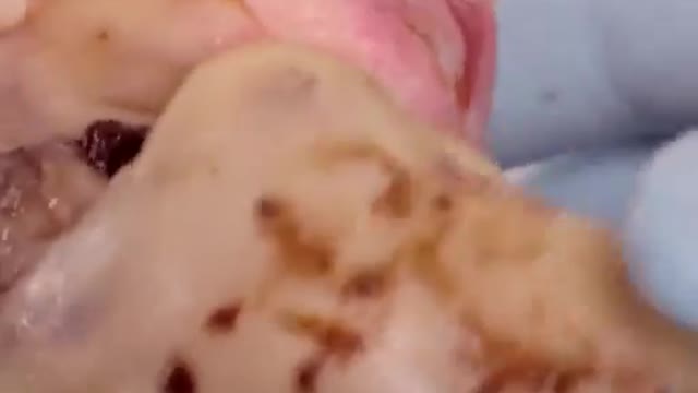 WARNING: Horrible Graphic Pictures…